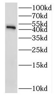 RPL3 Rabbit Polyclonal Antibody