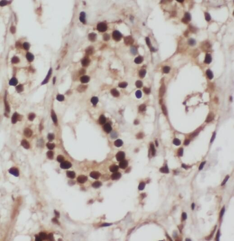 RPL3 Rabbit Polyclonal Antibody
