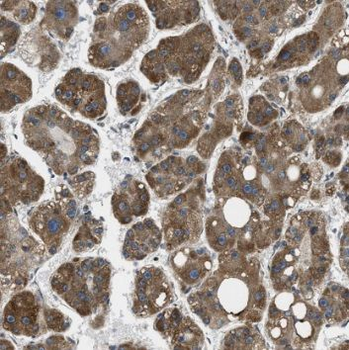RPL36AL Rabbit Polyclonal Antibody