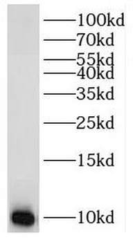 RPL37A Rabbit Polyclonal Antibody