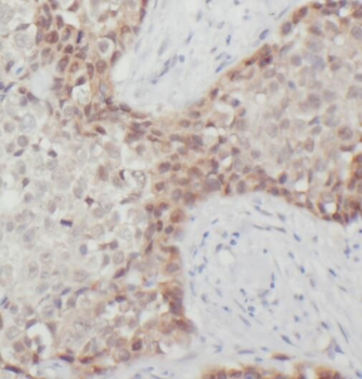 RPL37A Rabbit Polyclonal Antibody