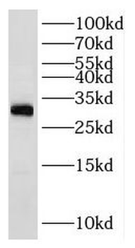 RPL7A Rabbit Polyclonal Antibody