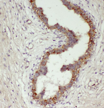 RPL7A Rabbit Polyclonal Antibody