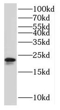 Rpl9 Rabbit Polyclonal Antibody