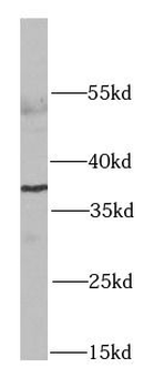 RPLP0 Rabbit Polyclonal Antibody