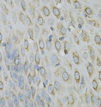 RPLP0 Rabbit Polyclonal Antibody