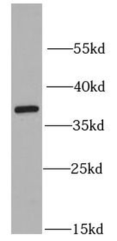 RPLP0 Rabbit Polyclonal Antibody