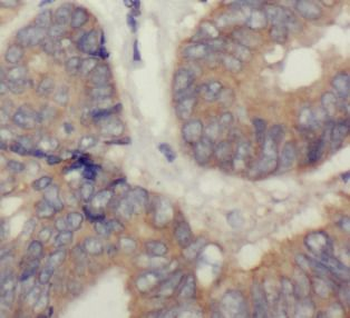 RPLP0 Rabbit Polyclonal Antibody