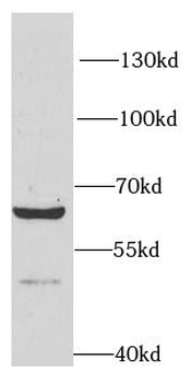RPN1 Rabbit Polyclonal Antibody
