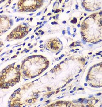 RPN1 Rabbit Polyclonal Antibody