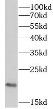 RPP21 Rabbit Polyclonal Antibody
