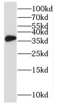 RPRD1B Rabbit Polyclonal Antibody
