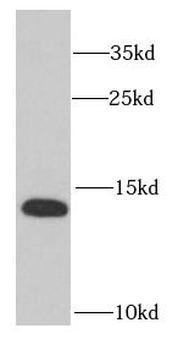 RPS12 Rabbit Polyclonal Antibody