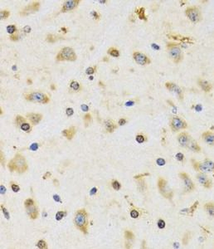 RPS12 Rabbit Polyclonal Antibody