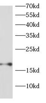 RPS13 Rabbit Polyclonal Antibody