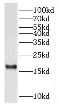 RPS15 Rabbit Polyclonal Antibody