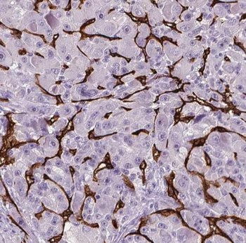 RPS15 Rabbit Polyclonal Antibody