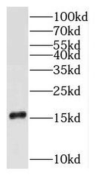 RPS16 Rabbit Polyclonal Antibody