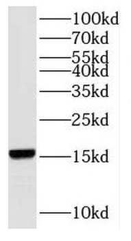 RPS19 Rabbit Polyclonal Antibody