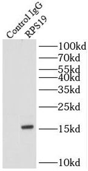 RPS19 Rabbit Polyclonal Antibody