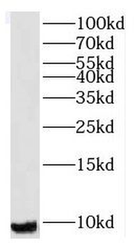 RPS21 Rabbit Polyclonal Antibody