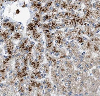 RPS25 Rabbit Polyclonal Antibody