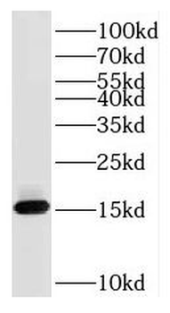 RPS26 Rabbit Polyclonal Antibody