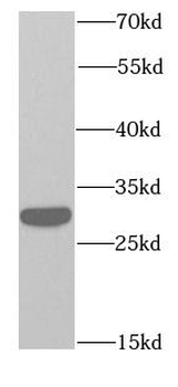 RPS3 Rabbit Polyclonal Antibody