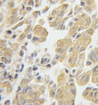 RPS3 Rabbit Polyclonal Antibody