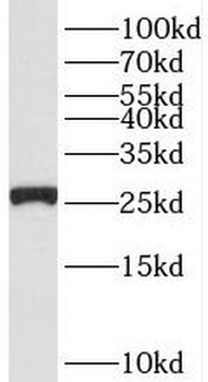 RPS3 Rabbit Polyclonal Antibody