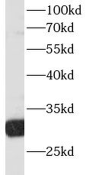 RPS3 Mouse Monoclonal Antibody