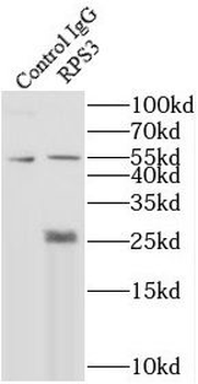 RPS3 Mouse Monoclonal Antibody