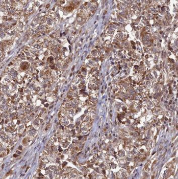 RPS3 Mouse Monoclonal Antibody