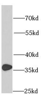 RPS3A Rabbit Polyclonal Antibody