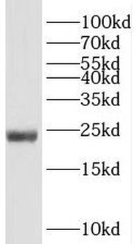 RPS5 Rabbit Polyclonal Antibody