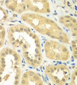 RPS6KL1 Rabbit Polyclonal Antibody