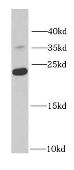 RPS7 Rabbit Polyclonal Antibody