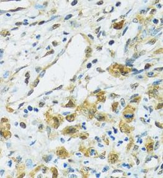 RPS7 Rabbit Polyclonal Antibody
