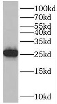 RPS8 Rabbit Polyclonal Antibody
