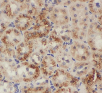 RPS9 Rabbit Polyclonal Antibody