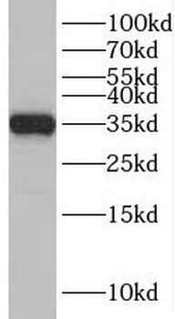 CNOT9 Antibody