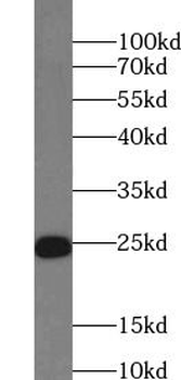 RRAS Rabbit Polyclonal Antibody
