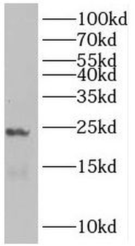 RRAS2 Rabbit Polyclonal Antibody