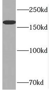 RRBP1 Rabbit Polyclonal Antibody