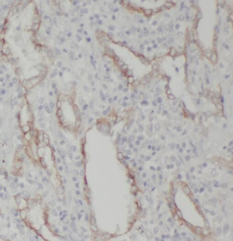 RRBP1 Rabbit Polyclonal Antibody