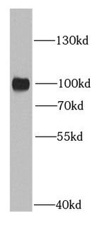 RRM1 Rabbit Polyclonal Antibody