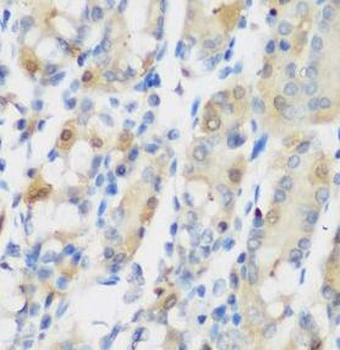 RRM1 Rabbit Polyclonal Antibody