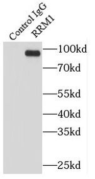 RRM1 Mouse Monoclonal Antibody