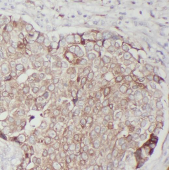 RRM1 Mouse Monoclonal Antibody