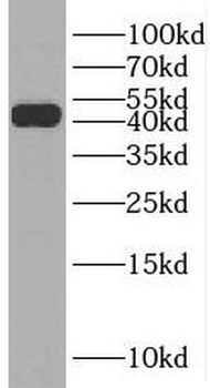 RRM2 Rabbit Polyclonal Antibody